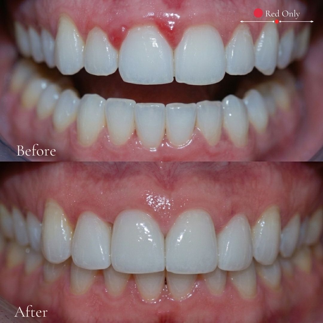 Daily Gumline Defense System