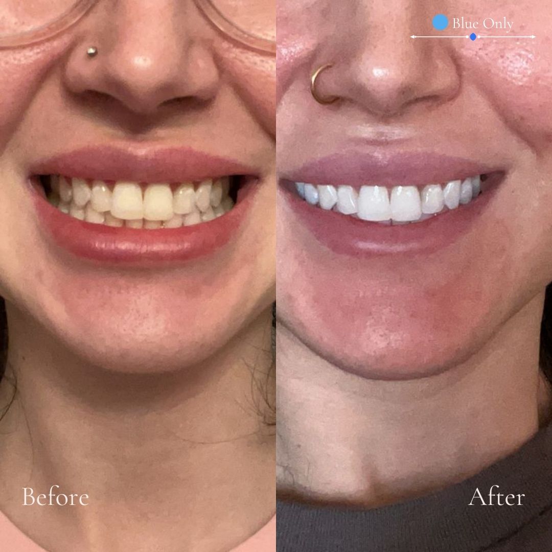 Daily Gumline Defense System