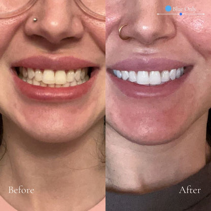 Daily Gumline Defense System